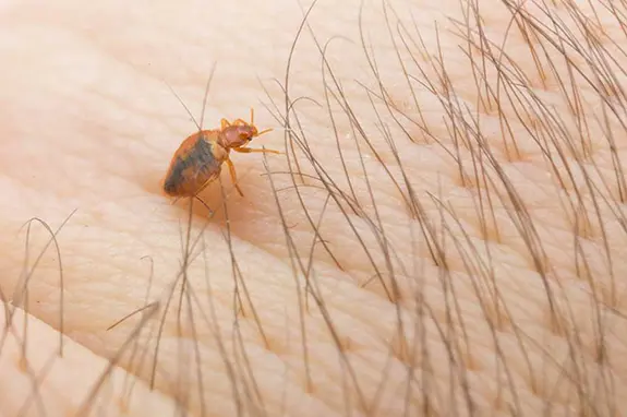 Closeup of a bed bug on a person's hand